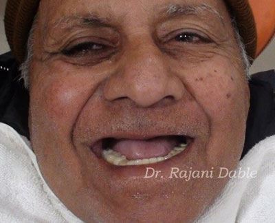 Dentist in Kandivali